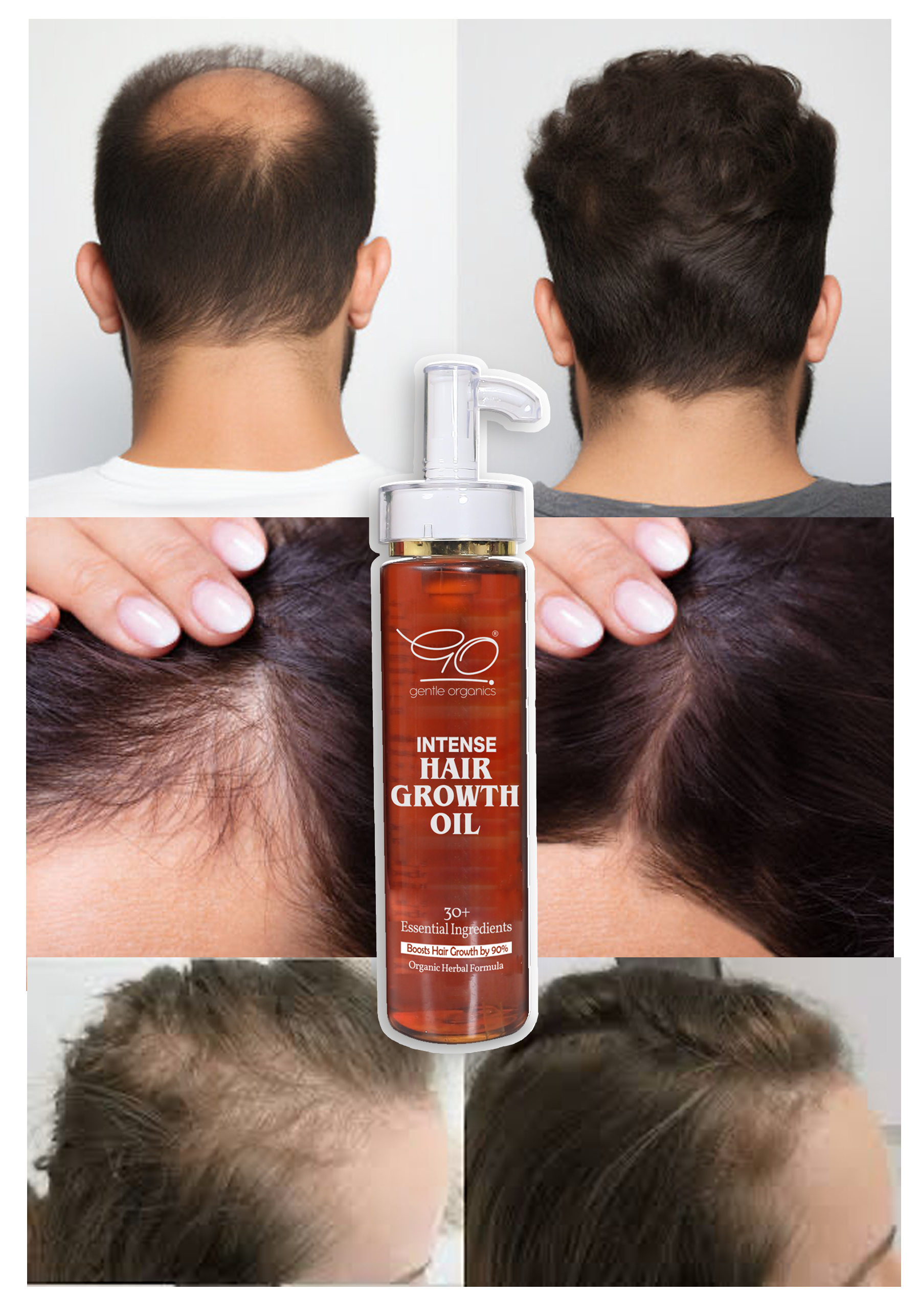 Intense Hair Growth Oil - 100% Natural